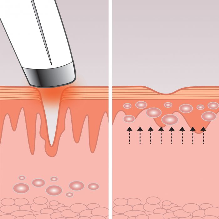 Массажер для глаз Eye Revive Luxe